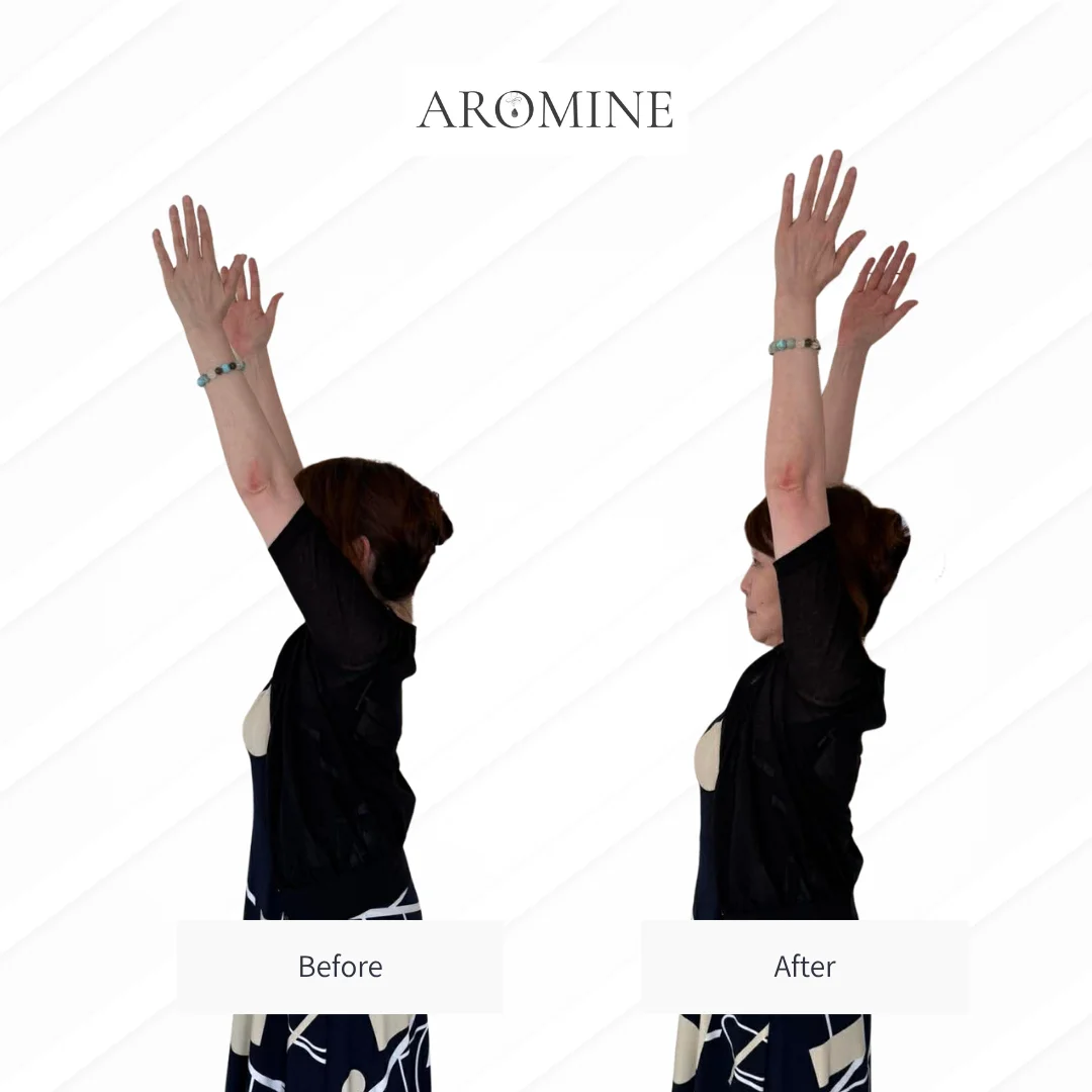 AROMINE 制作クラスのBefore / After事例 6
