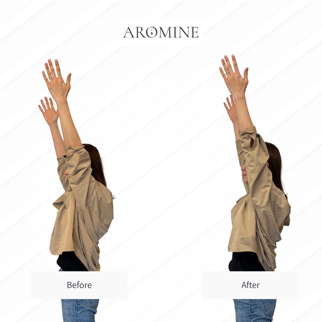 AROMINE 制作クラスのBefore / After事例 7